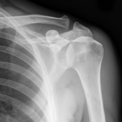Shoulder